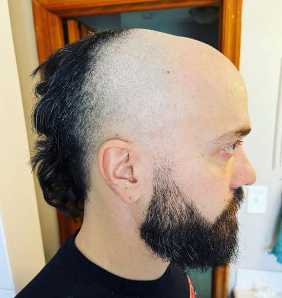 Short Skullet