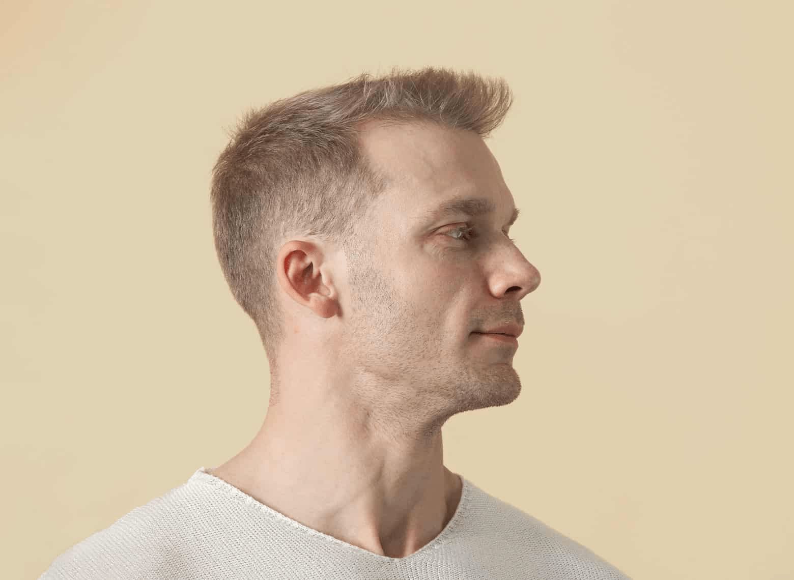 receding hairline haircut gallery