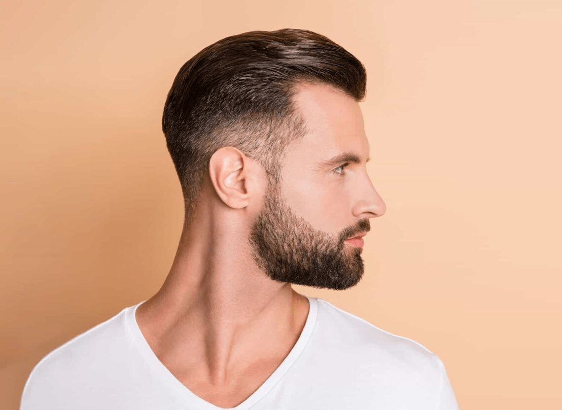 receding hairline haircut gallery