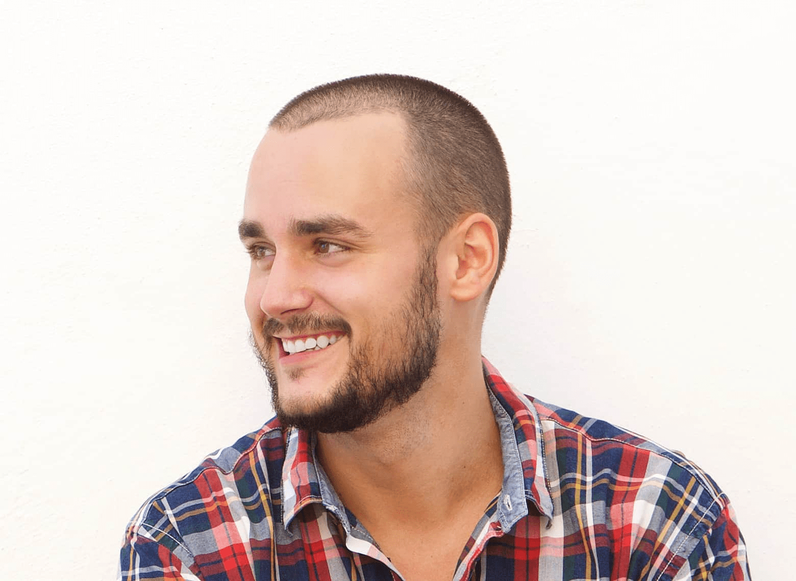 receding hairline haircut gallery